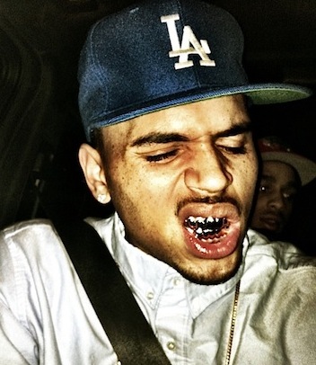 Chris-Brown-Gold-Teeth-4