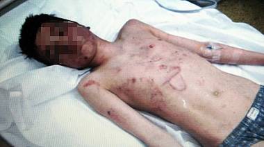 13let_chlapec_zmlaceny_bohosudov_krupka_romove_o__6__denik-380