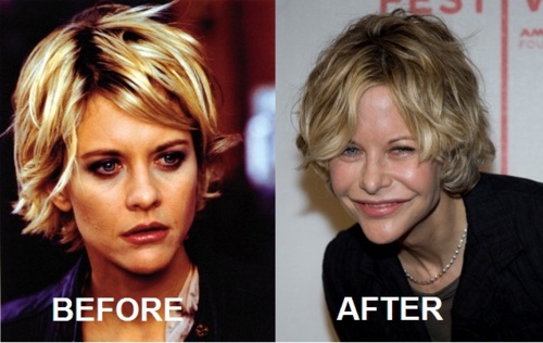 meg-ryan