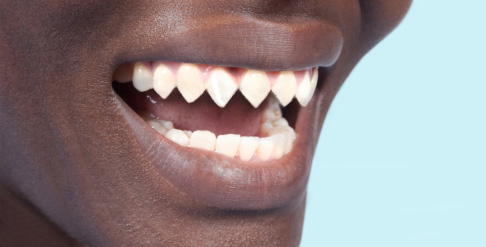natural teeth