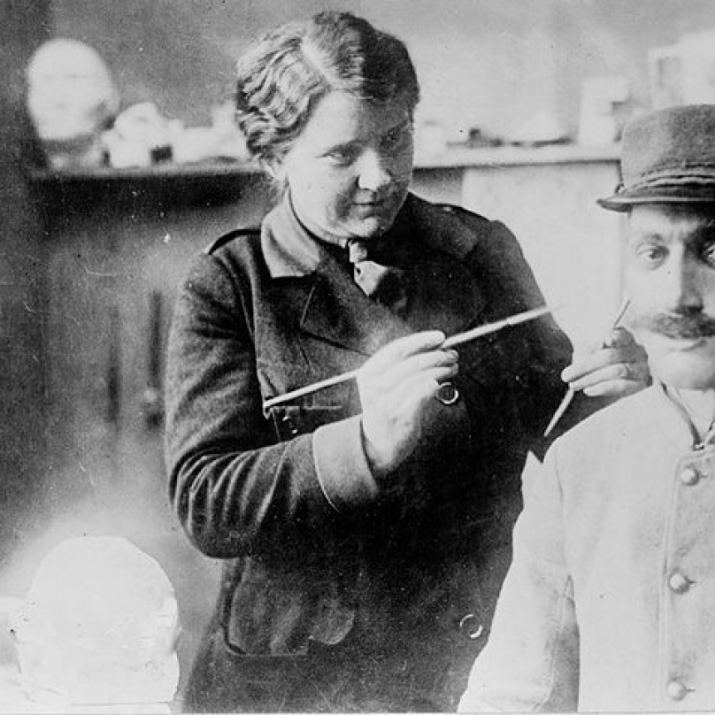 Doktoři nedokázali napravit všechna zranění. Obličejová maska fungovala jako psychická vzpruha. Byly modelovány podle fotografie pořízené před zraněním.